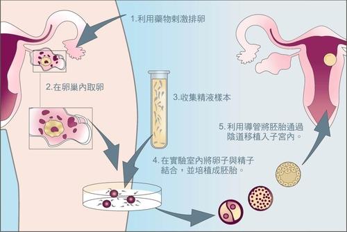 人工授精一周后出血