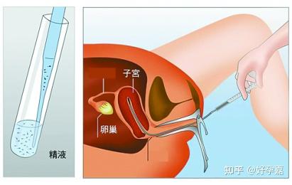 「哪里可以代怀孩子婴儿过程用药」每30秒一个缺陷儿出生