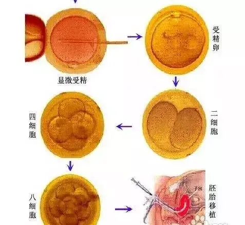 同性男男代生胚胎单核多核的区别有哪些